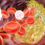 How to raise good cholesterol: Doctor shares 5 key lifestyle changes to boast HDL (Photo- Getty Image)