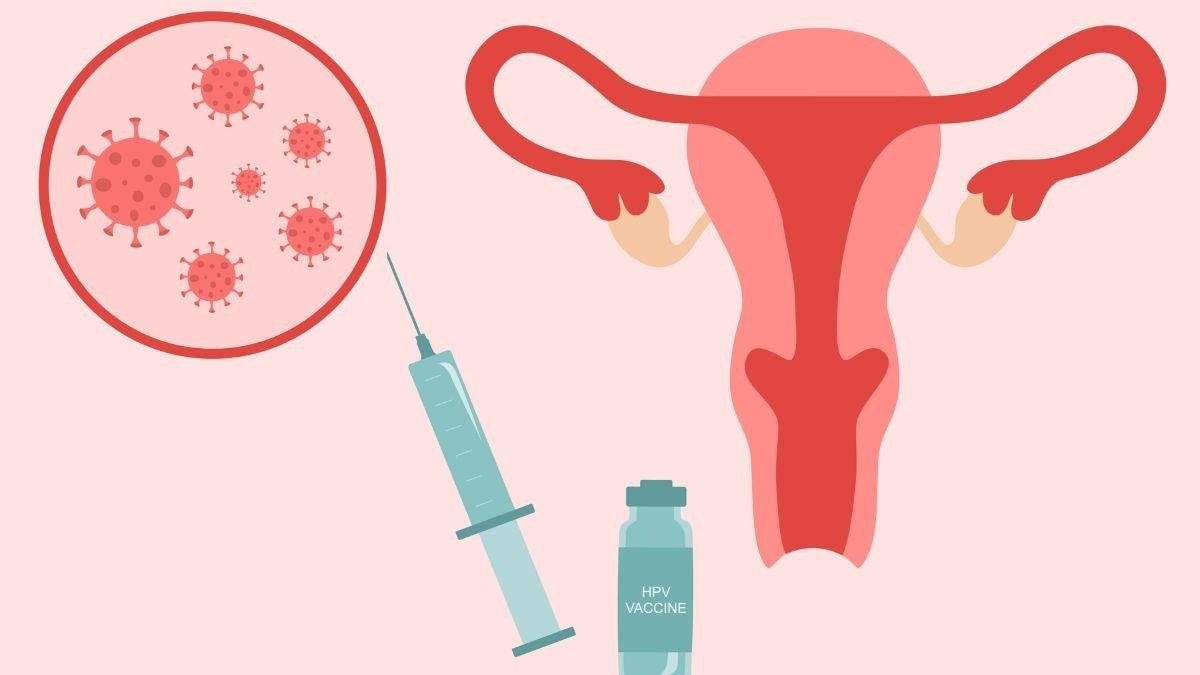 The vaccine being used in the nationwide HPV vaccine rollout is Gardasil4