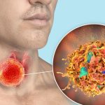 Oral sex emerging as a major cause of throat cancer in India.