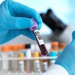The lab report gamble: India’s continued diagnostic quality crisis