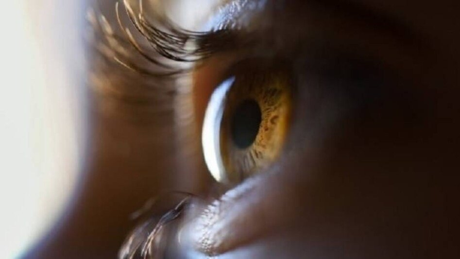 Dry eye is a common condition in people using screens for long hours