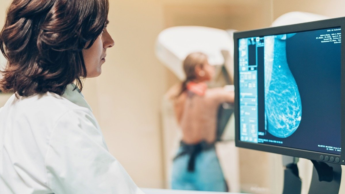 Eating a high-fat diet after a breast cancer diagnosis can lead cancer to spread faster