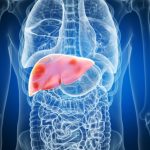 Fatty liver disease to affect 2 billion people by 2050.