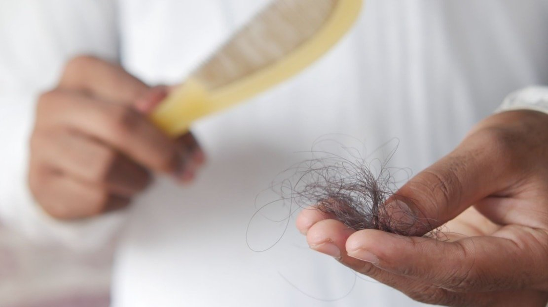 New study links Ozempic-like drugs to slightly higher hair loss risk