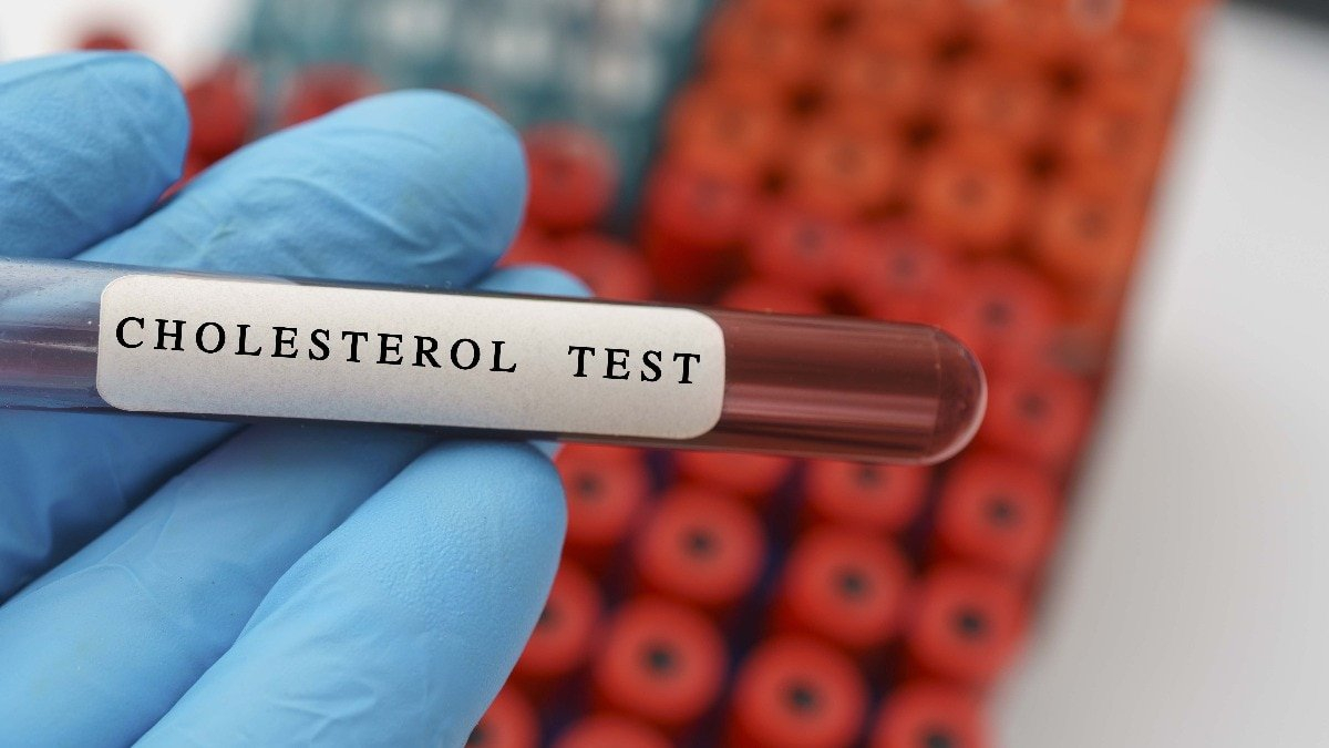 One shot to lower bad cholesterol? What we know about Verve 102
