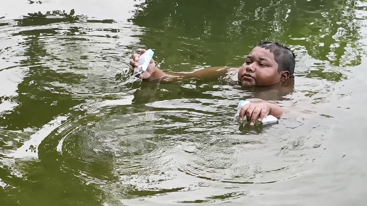 He stays in a pond for hours, as coming out burns his skin. What is Aquagenic Pruritus? (Image: X/@@aajtak)