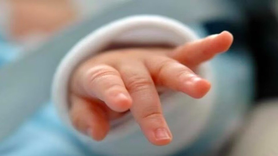 C-section surge reignites birth surgery debate (Photo: Representational )