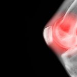 Why your knees pop and crack