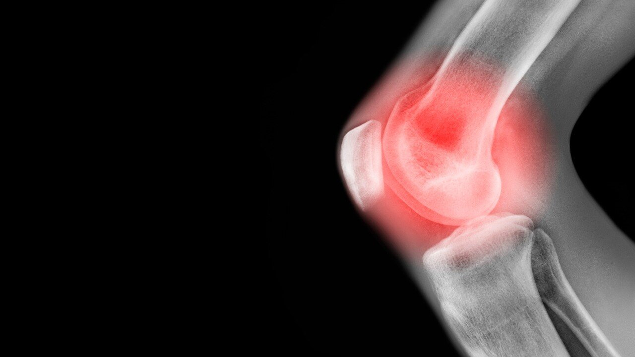 Why your knees pop and crack