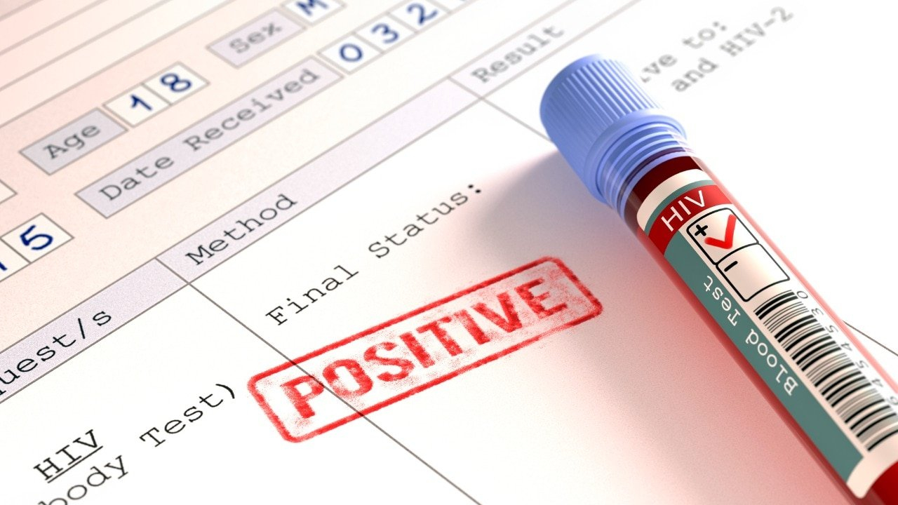India’s HIV infections are rising quietly. Why twice-yearly lenacapavir matters