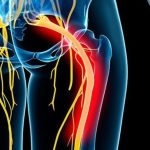 Cancer drug target linked to pain