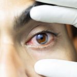 H1N1 can affect the eyes too. Watch for these warning signs as flu surges