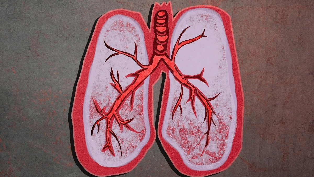 Can your everyday lifestyle affect your lung cancer risk?