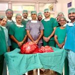 Jaipur doctors remove 28.6-kg retroperitoneal tumour from woman